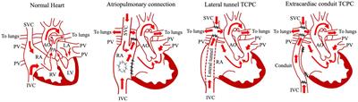 Fontan-associated liver disease: the importance of multidisciplinary teamwork in its management